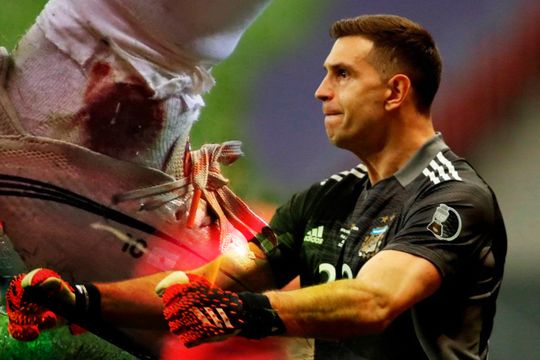 Argentina finalista: el tobillo de Messi y las manos de Martínez recorrieron el mundo.