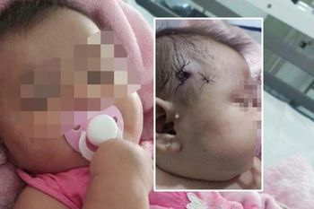 La beba de 5 meses fue atendida en el Hospital y su vida no corre peligro