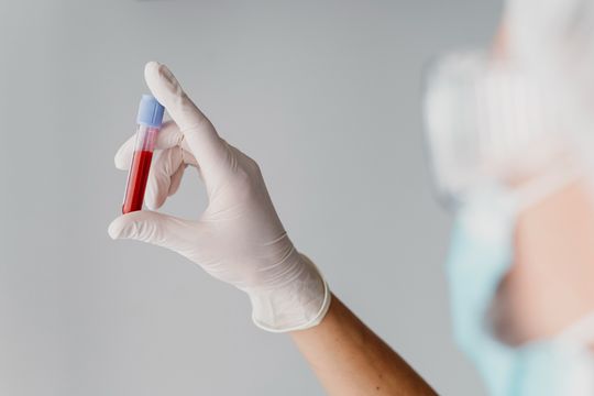 Realizan testeos gratuitos de HIV y sífilis en La Costa: ¿dónde y cuándo realizarlos?