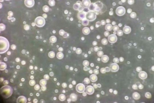 como se ve una gota de leche materna bajo el microscopio