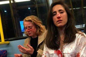 ataque homofobico: golpean brutalmente a una pareja de mujeres en londres