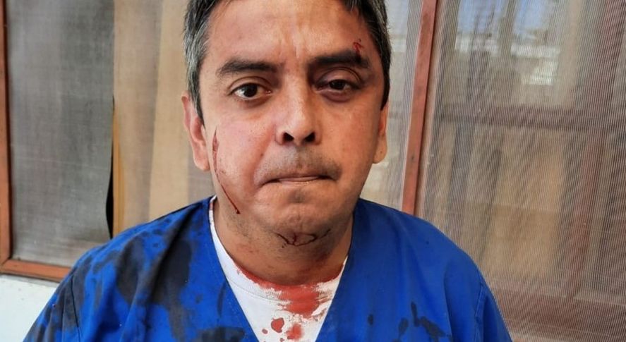 El exsecretario de Salud de General Lavalle, Marcelo Cachagua, fue agredido por un paciente