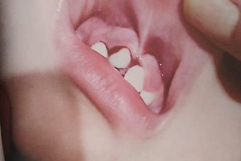 Un bebé perdió un diente tras la salvaje agresión