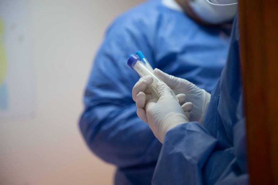 El Ministerio de Salud Pública de la Nación anunció la cifra de muertes y contagios de coronavirus. 