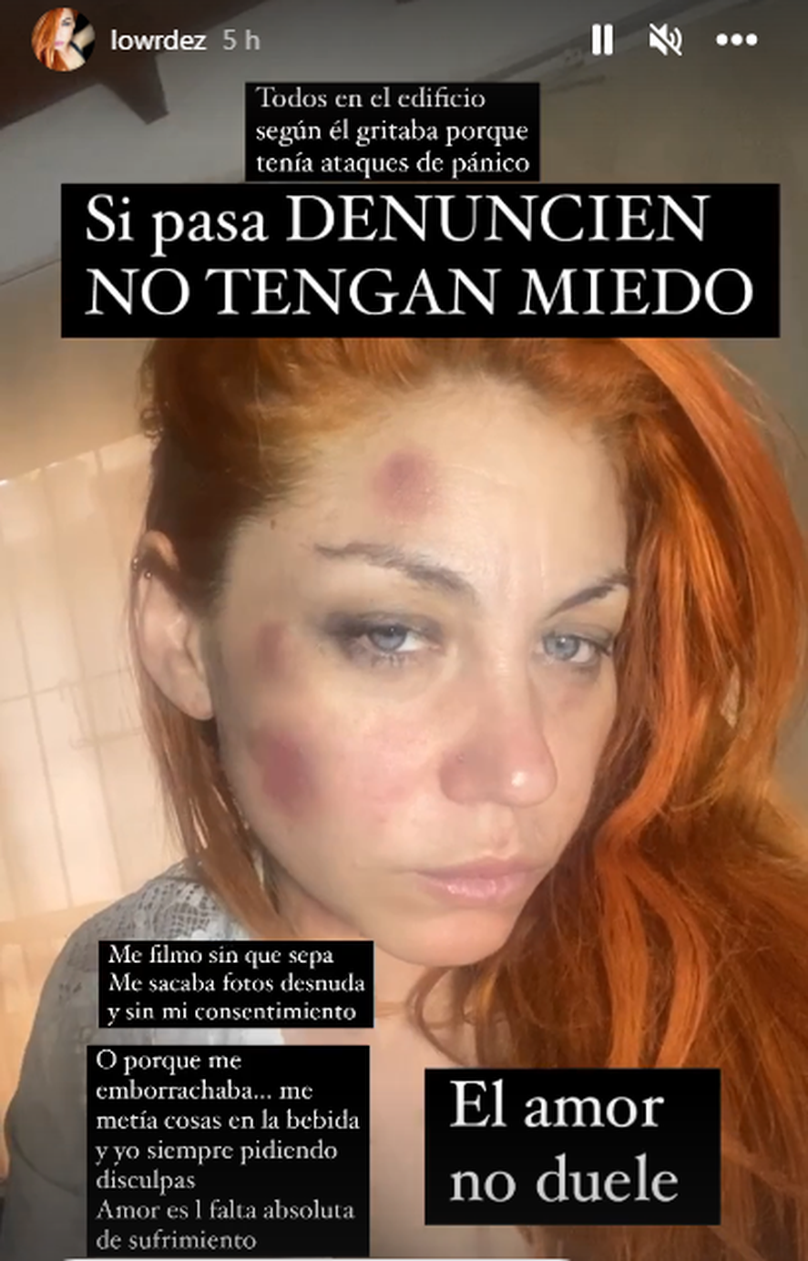 La cantante Lourdes de Bandana denunci&oacute; violencia de g&eacute;nero en sus redes sociales.