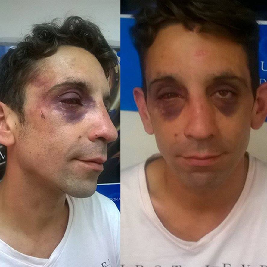 Activista LGTB de Mar del Plata atacado por el grupo neonazi en 2015.