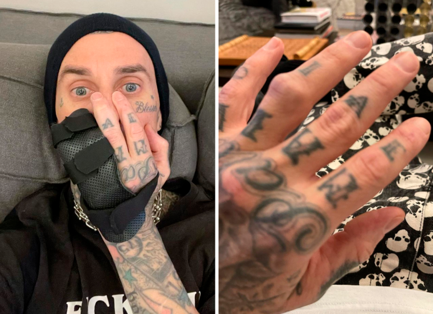 Twitter y sus comparaciones: Travis Barker sufrió una lesión en su dedo y por ese motivo Blink-182, suspendió todos los shows.