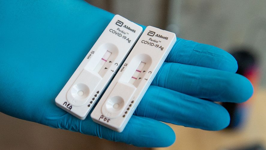 Coronavirus: Autorizan el uso de 4 test de autoevaluación