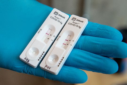 Coronavirus: Autorizan el uso de 4 test de autoevaluación