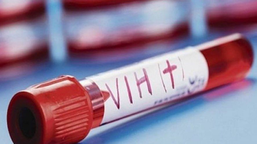 VIH y sífilis: presentan un manual de test rápido para equipos de salud