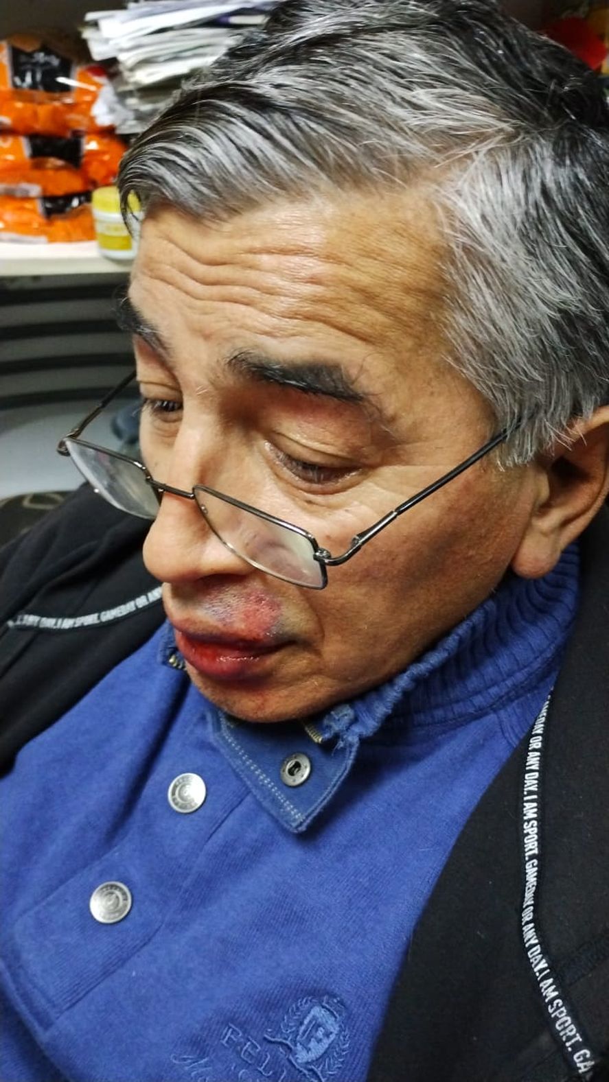 Otra de las imágenes que muestra al hombre de 65 años herido tras el golpe sufrido en el Shopping Plaza Oeste de Morón, y quedó agregada en una denuncia presentada en la comisaría 7 de Castelar