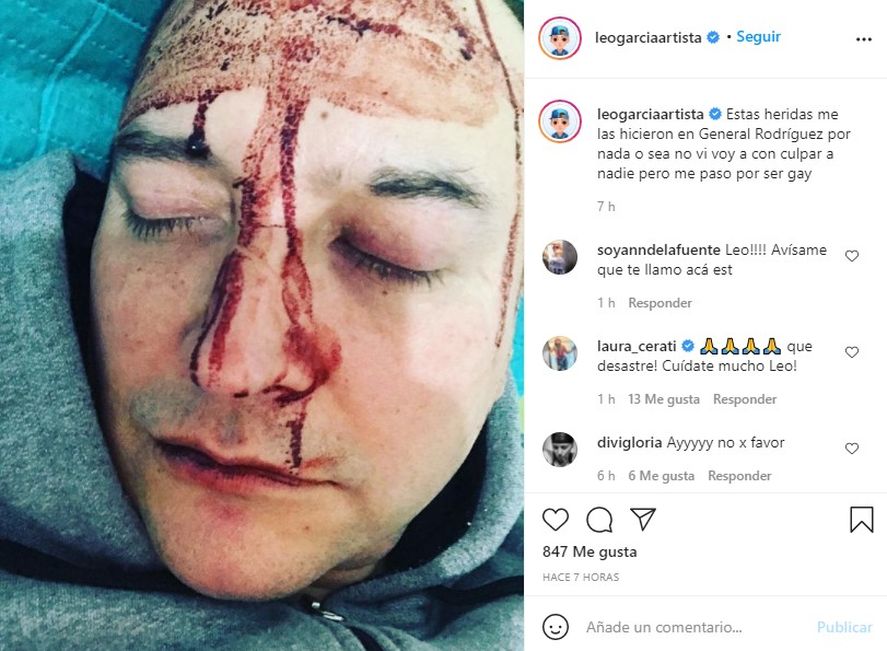 Leo García compartió su experiencia en Instagram