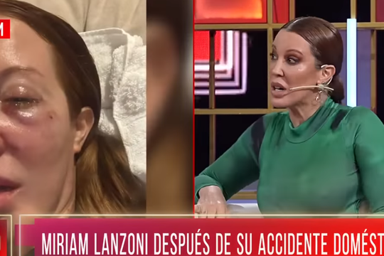 Miriam Lanzoni habló sobre el accidente que tuvo con su gato