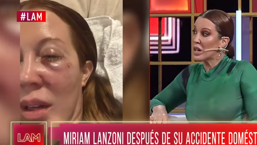 Miriam Lanzoni habló sobre el accidente que tuvo con su gato