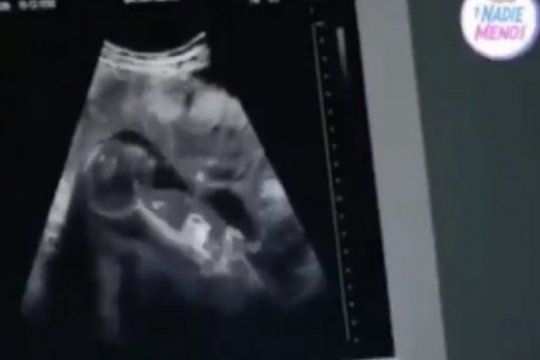 amalia granata subio un video sobre un aborto y genero indignacion en las redes